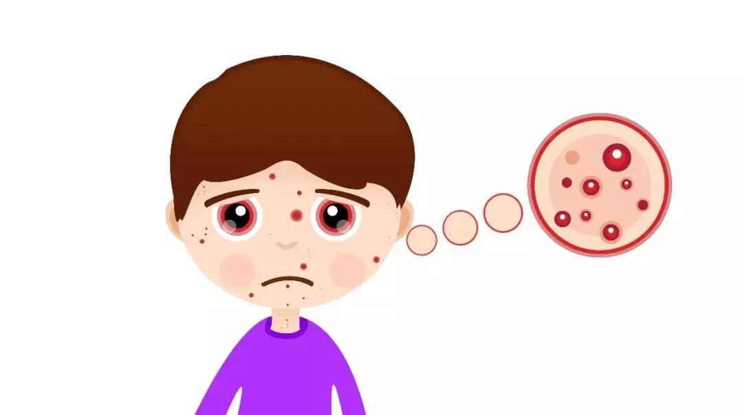 诱发湿疹的因素有哪些？